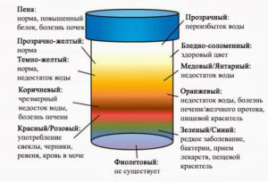 Моча ярко жёлтого цвета