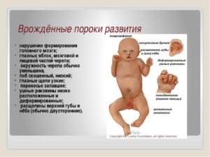 Осложнения беременности и пороки развития плода по генетическому анализу