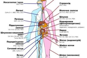 Повышен онкомаркер Scc 6.4