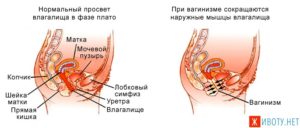 Сокращения мышц влагалища