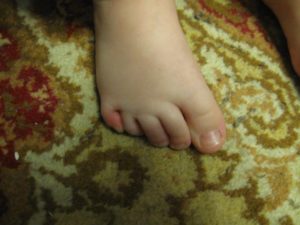 Беспокойный ребенок 1 год, поджимает пальчики на ногах