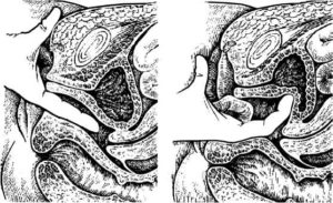 Не могу найти вход во влагалище