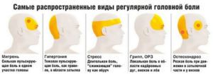 Острая головная боль в правом полушарии