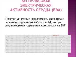 Повышение электрической активности