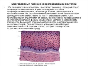 Расшифровка гистологии: Фрагмент многослойного плоского эпителия без подлежащих тканей