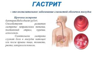 Гастрит не проходит