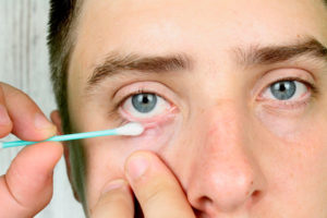 Ребенку намазали глаза тетрациклиновой мазью 3%, опасно ли это?