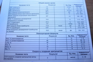 Какие анализы сдать перед первой консультацией с эндокринологом?