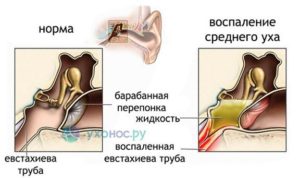 Пульсации в ушах в положении лёжа