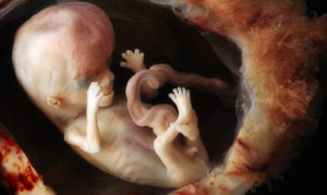 Плохо растет эмбрион