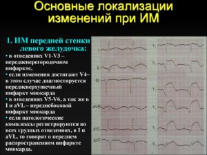 Изменения миокарда левого желудочка