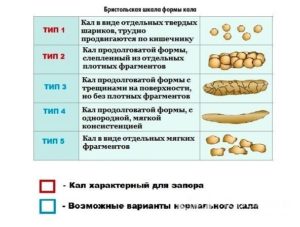 Запоры, твердый кал