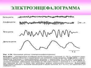 Эпиактивность что это такое