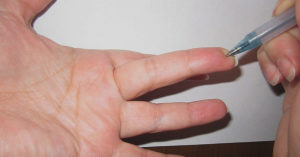 Боль при нажатии на кончики пальцев