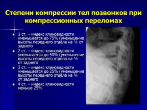 Перелом компрессионный 1-2 степени 12позвонка