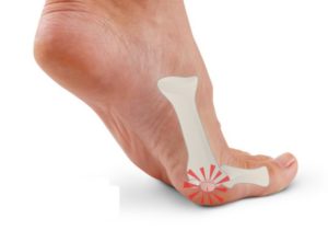 Боль подушечки большого пальца ноги