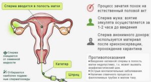 Вероятность забеременеть если сперма попала только на половые губы