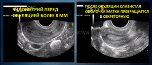 После овуляции эндометрий уменьшился