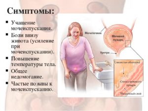 Может ли быть нормой, когда болит живот перед туалетом