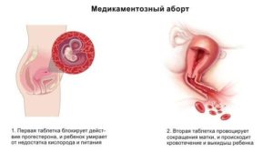 Медикаментозный аборт - вопрос по выделениям
