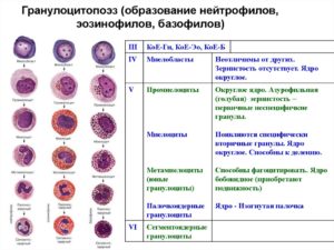 Отсутствие в крови базофилов и эозинофилов