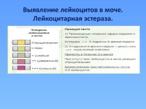 Следы лейкоцитарной эстеразы в моче