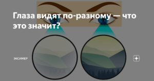 Один глаз видит хуже. Глаза видят по разному. Глаза воспринимают по разному. Глаза видят по разному видят?. Глаза видят по разному как называется.