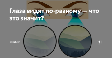 Почему мы видим по разному. Глаза видят по разному. Глаза видят по разному видят?. Глаза видят по разному как называется. Почему глаза видят по разному.