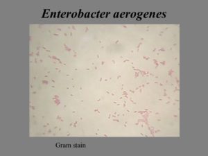 Обнаружили в зеве enterobacter aerogenes