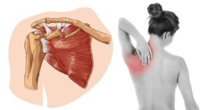 Боль в правой лопатке при движении рукой