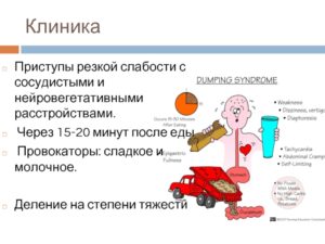 Приступы резкой слабости