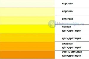 Моча ярко-желтого или ярко-лимонного даже цвета бывает