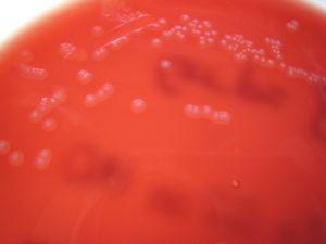 Лечение Streptococcus agalactiae 10 в 6
