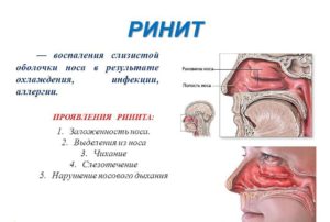 Заложен нос и болит горло