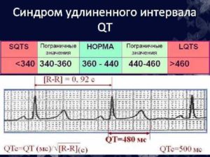 Удлиненный Qt у ребенка