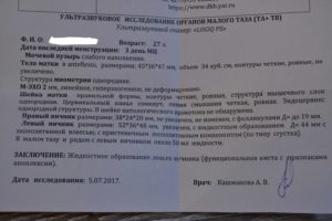 Киста на фоне приема Жанина