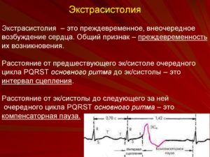 Беременность и сильные экстрасистолы