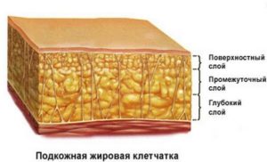 Утолщение жировой клетчатки