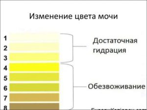 Моча ярко жёлтого цвета