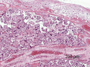 Гистология плаценты