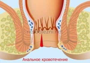 Сухость слизистой в прямой кишке