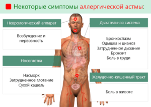 Затрудненное дыхание без кашля, подозрение на аллергию