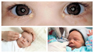 Ребенку намазали глаза тетрациклиновой мазью 3%, опасно ли это?