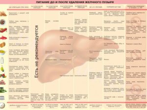 Температура 40 и сильная боль после удаления желчного пузыря