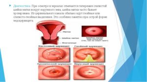 Шейка матки гиперемирована в области наружного зева