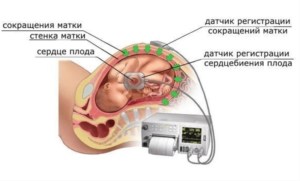 Ктг и доплер